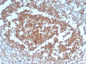 Immunohistochemical analysis of formalin-fixed, paraffin-embedded human tonsil using Anti-CD40 Antibody [C40/4826R]