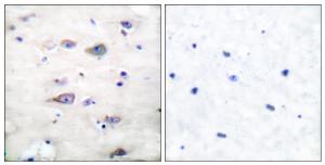 Immunohistochemical analysis of paraffin-embedded human brain using Anti-GluR2 (phospho Ser880) Antibody. The right hand panel represents a negative control, where the Antibody was pre-incubated with the immunising peptide