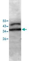 Anti-ECI2 Rabbit Polyclonal Antibody