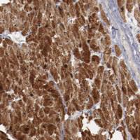 Anti-MYOM2 Rabbit Polyclonal Antibody