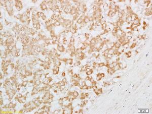 Anti-CPE Rabbit Polyclonal Antibody