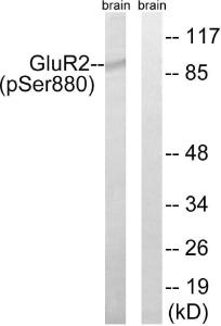 Western blot analysis of lysates from mouse brain using Anti-GluR2 (phospho Ser880) Antibody. The right hand lane represents a negative control, where the Antibody is blocked by the immunising peptide