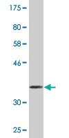 Anti-EPHB1 Mouse Monoclonal Antibody [clone: 4G6]