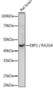 Anti-EBP1 Rabbit Monoclonal Antibody [Clone: ARC1281]