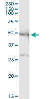 Anti-PBX2 Antibody Pair