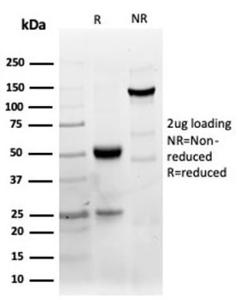 SDS-PAGE analysis of Anti-CD40 Antibody [C40/4826R] under non-reduced and reduced conditions; showing intact IgG and intact heavy and light chains, respectively. SDS-PAGE analysis confirms the integrity and purity of the Antibody