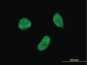 Anti-ZNF7 Mouse Monoclonal Antibody [clone: 6F2]