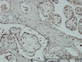 Anti-ZNF345 Mouse Monoclonal Antibody [clone: 6G10]