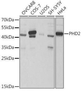 Western blot analysis of extracts of various cell lines, using Anti-PHD2/prolyl hydroxylase Antibody (A13327) at 1:1,000 dilution The secondary antibody was Goat Anti-Rabbit IgG H&L Antibody (HRP) at 1:10,000 dilution Lysates/proteins were present at 25 µg per lane