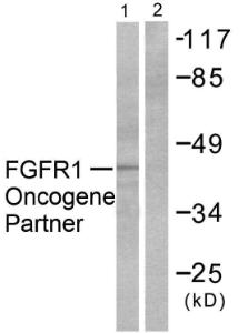 Western blot analysis of lysates from HepG2 cells using Anti-FGFR1 Oncogene Partner Antibody. The right hand lane represents a negative control, where the antibody is blocked by the immunising peptide