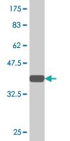 Anti-PCGF2 Mouse Monoclonal Antibody [clone: 4D6]