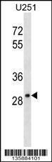 Anti-FAIM2 Rabbit Polyclonal Antibody (Biotin)