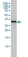 Anti-PDCL3 Mouse Monoclonal Antibody [clone: 1F10]