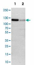 Anti-PAPOLA Rabbit Polyclonal Antibody