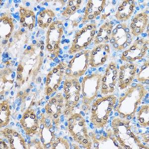 Immunohistochemistry analysis of paraffin-embedded rat kidney using Anti-PHD2/prolyl hydroxylase Antibody (A13327) at a dilution of 1:100 (40x lens) Perform microwave antigen retrieval with 10 mM PBS buffer pH 72 before commencing with IHC staining protocol