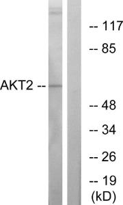 Western blot analysis of lysates from A2780 cells, treated with TNF-alpha using Anti-Akt2 Antibody. The right hand lane represents a negative control, where the antibody is blocked by the immunising peptide