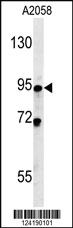 Anti-SMPD4 Rabbit Polyclonal Antibody