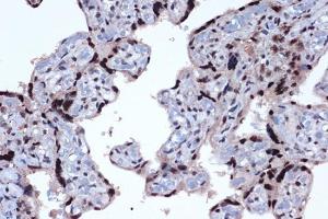 Immunohistochemistry analysis of paraffin-embedded human placenta using Anti-JunD Antibody [ARC1409] (A307304) at a dilution of 1:100 (40X lens). Perform microwave antigen retrieval with 10 mM Tris/EDTA buffer pH 9.0 before commencing with IHC staining protocol