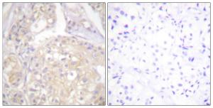 Antibody anti-FGFR1 phospho TYR766 100 µg