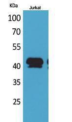 Western blot analysis of Jurkat cells using Anti-BMP8A Antibody