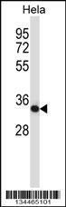 Anti-CSNK2A2 Rabbit Polyclonal Antibody (PE (Phycoerythrin))