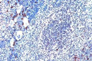 Immunohistochemistry analysis of paraffin-embedded mouse spleen using Anti-JunD Antibody [ARC1409] (A307304) at a dilution of 1:100 (40X lens). Perform microwave antigen retrieval with 10 mM Tris/EDTA buffer pH 9.0 before commencing with IHC staining protocol