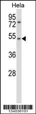 Anti-CHRNA7 Rabbit Polyclonal Antibody (FITC (Fluorescein Isothiocyanate))