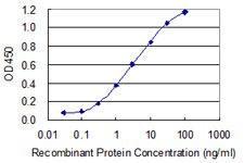 Anti-ATP6V1A Mouse monoclonal antibody unconjugated [clone: 4F5]