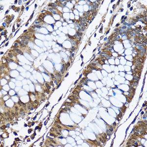 Immunohistochemistry analysis of paraffin-embedded human colon tissue using Anti-PHD2/prolyl hydroxylase Antibody (A13327) at a dilution of 1:100 (40x lens) Perform microwave antigen retrieval with 10 mM PBS buffer pH 72 before commencing with IHC staining protocol