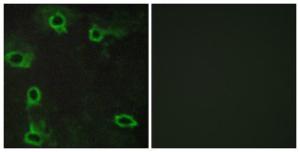 Immunofluorescence analysis of COS7 cells using Anti-ADORA2A Antibody. The right hand panel represents a negative control, where the antibody was pre-incubated with the immunising peptide