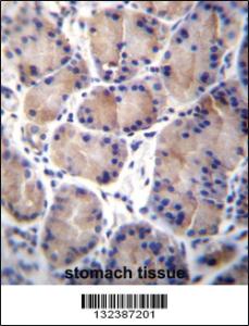 Anti-CES4A Rabbit Polyclonal Antibody