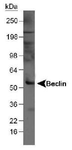 Anti-PDK4 Rabbit Polyclonal Antibody (HRP (Horseradish Peroxidase))