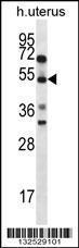 Anti-ABRA Rabbit Polyclonal Antibody (HRP (Horseradish Peroxidase))