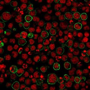 Antibody anti-CD20 SPM618 100 µg