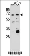 Anti-CES4A Rabbit Polyclonal Antibody