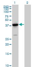 Anti-FANCL Mouse Polyclonal Antibody