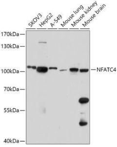 Western blot analysis of extracts of various cell lines, using Anti-NFATC4 Antibody (A308318) at 1:1,000 dilution. The secondary antibody was Goat Anti-Rabbit IgG H&L Antibody (HRP) at 1:10,000 dilution.