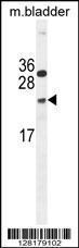 Anti-NUDT15 Rabbit Polyclonal Antibody (HRP (Horseradish Peroxidase))