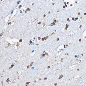 Immunohistochemistry analysis of paraffin-embedded mouse brain using Anti-PHD2/prolyl hydroxylase Antibody (A13327) at a dilution of 1:100 (40x lens) Perform microwave antigen retrieval with 10 mM PBS buffer pH 72 before commencing with IHC staining protocol