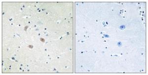 Immunohistochemical analysis of paraffin-embedded human brain tissue using Anti-Akt2 Antibody. The right hand panel represents a negative control, where the antibody was pre-incubated with the immunising peptide