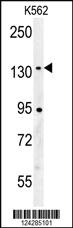 Anti-CILP2 Rabbit Polyclonal Antibody