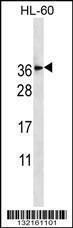 Anti-TM4SF1 Rabbit Polyclonal Antibody (AP (Alkaline Phosphatase))