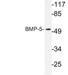 Anti-BMP-5 antibody