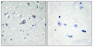 Immunohistochemical analysis of paraffin-embedded human brain tissue using Anti-ADORA2A Antibody. The right hand panel represents a negative control, where the antibody was pre-incubated with the immunising peptide