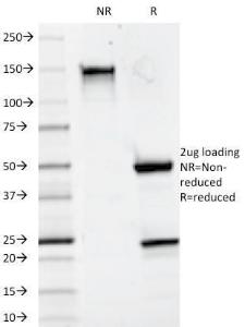 SDS-PAGE analysis of Anti-CD20 Antibody [93-1B3] under non-reduced and reduced conditions; showing intact IgG and intact heavy and light chains, respectively SDS-PAGE analysis confirms the integrity and purity of the antibody