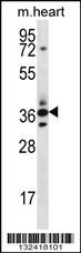 Anti-SFRP5 Rabbit Polyclonal Antibody