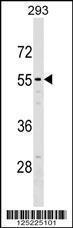 Anti-NT5D2 Rabbit Polyclonal Antibody (AP (Alkaline Phosphatase))