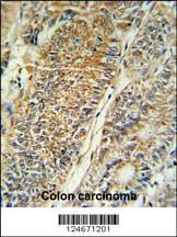 Anti-PYCR1 Rabbit Polyclonal Antibody (PE (Phycoerythrin))