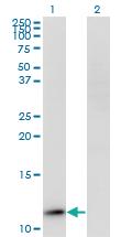 Anti-RPP14 Mouse Monoclonal Antibody [clone: 3H4]