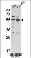 Anti-TMPRSS2 Rabbit Polyclonal Antibody